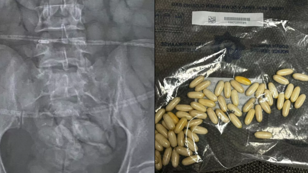 Woman Arrested at Airport Security After X-Ray Reveals Drugs Inside Her