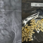 Woman Arrested at Airport Security After X-Ray Reveals Drugs Inside Her